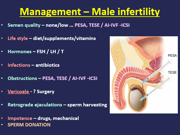 management male infertility